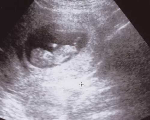 古玩网上在线鉴定_圆明园106件出土文物 历经浩劫如何幸存