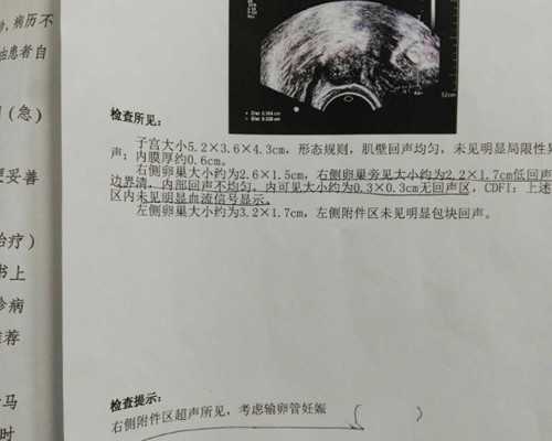 怀孕在香港验血就可以查男女吗_假如给我三天光明习题及答案《假如给我三天
