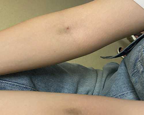 怀孕6周去香港验血准吗_香港验血是骗局2017?我的亲身经历希望可以帮到你