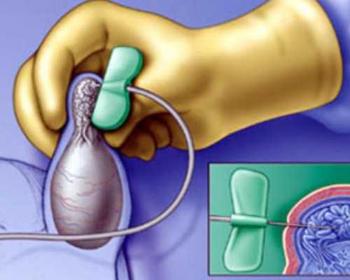 香港验血男女几天出结果,这几个时刻更有利于优生优育，备孕要把握好！