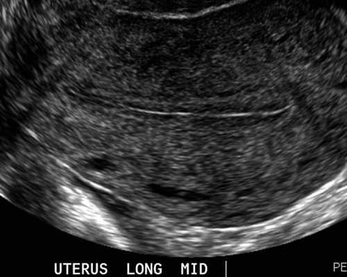 怀孕初期多久香港验血,香港验血可以知道宝宝的性别_鉴定性别的真实性是多少