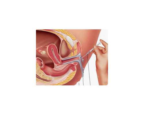 孕9 2香港验血13个D2个ND_2个月怀孕验血,总结了下个人经验跟大家分享下
