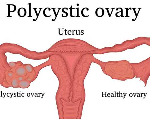 香港验血达雅高不准_香港查血验男女后悔_是不是真的靠谱!