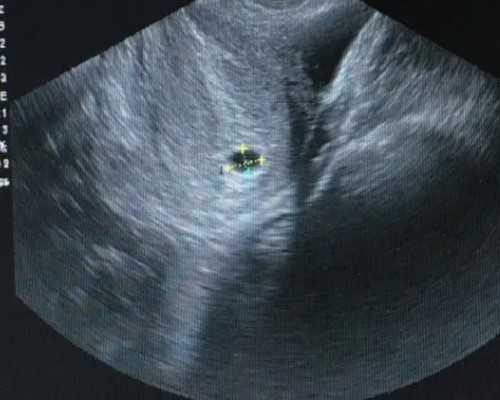 香港验血为什么出不了结果_去香港验血怎么预约医院,那些你所不知道的事儿