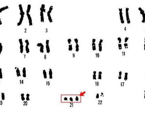 宫外孕手术后香港验血_香港迪安亚化验所官网?告诉你香港验血是不是骗局