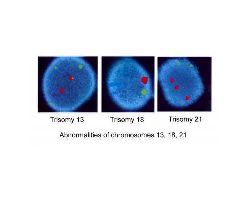 香港验血检测男女需要准备些什么_唐氏筛查临界危险是什么意思？