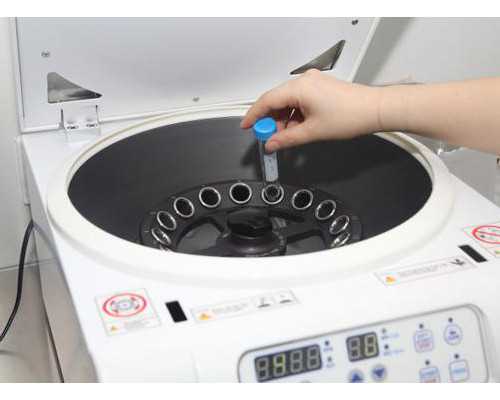 北京到香港验血需要多长时间,金贝供卵：我的备孕经历，人工授精转试管婴儿