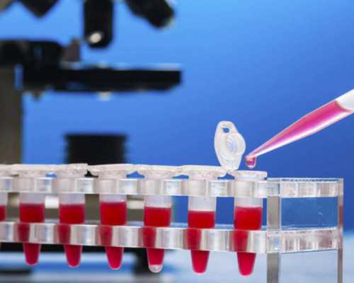 香港验血联系电话_香港验血选诊所_香港验血查男女什么价格,该怎么验