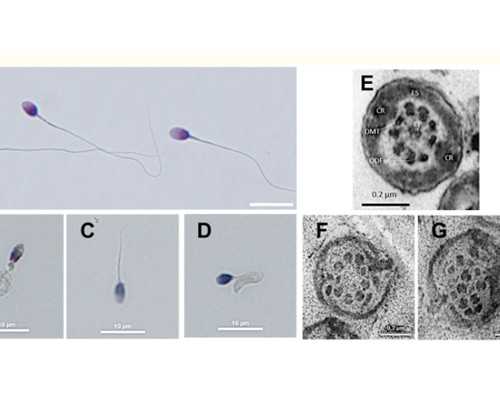 香港验血多久可以知道性别_香港47天验血准么_验血查男女需要什么流程!
