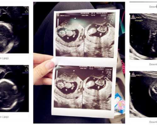 香港验血查男女很准吗_香港验血化验所过年放假通知_测胎儿性别机构哪家好