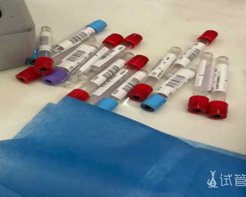 正规古玩公司上门交易_艺术收藏整体市场萎缩 大众收藏市场步入繁荣期