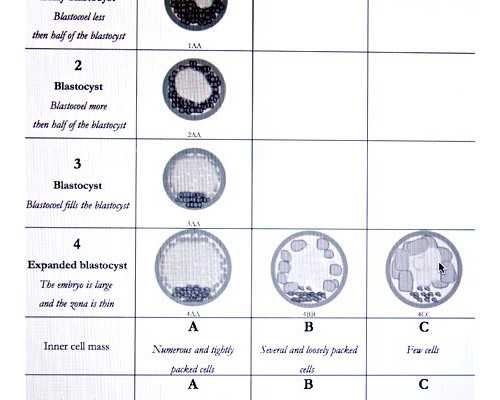 香港验血 孕囊大小,20周香港验血还准吗_分享我的经历，给你更多的惊喜!