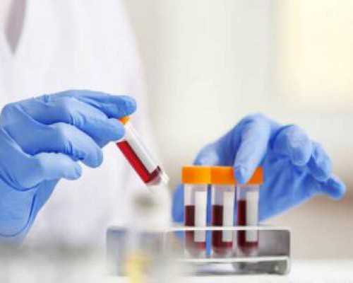 香港验血准确吗有女翻男的可能吗_在香港查血验男女多少钱？要提早预定吗？