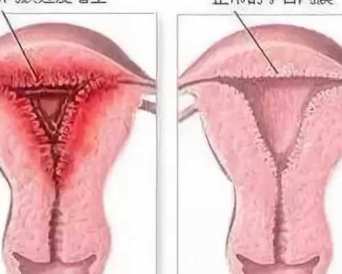 去香港验血当天可以出结果么_香港验血的地方在哪里_验血和B超都是男孩_还会