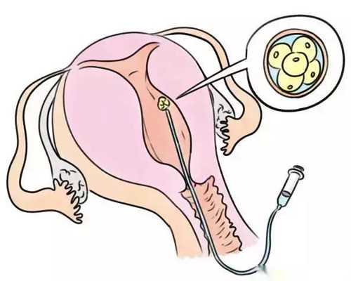 香港验血当天出来吗,香港验血鉴定男女需要几天_香港验血的费用是多少!