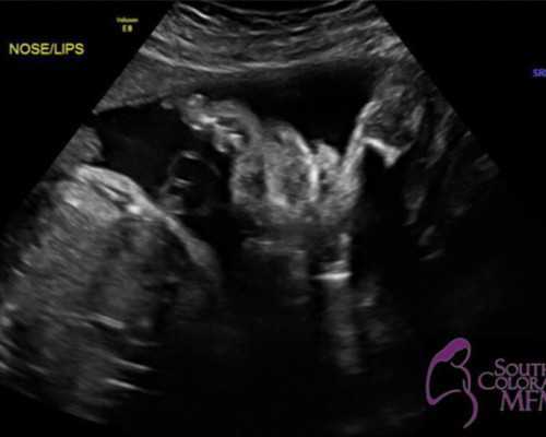 沉浮古玩虫一共几集,白羊男如何对待女朋友和女性朋友半斤八两