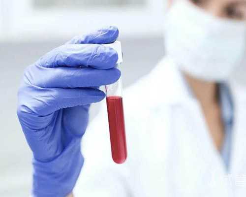 香港元基因是政府批准的验血机构吗,试管婴儿短方案失败的原因有五点，年级