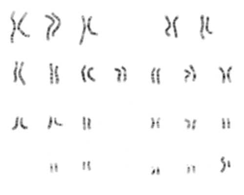 生化妊娠后再孕影响香港验血吗_香港时代基因验血男女准吗_香港验血查男女什