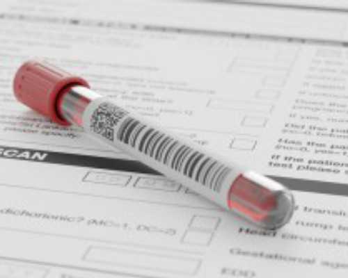 双胞胎去香港验血查性别准吗_香港查男女合法吗_8周验血B超翻盘信哪个