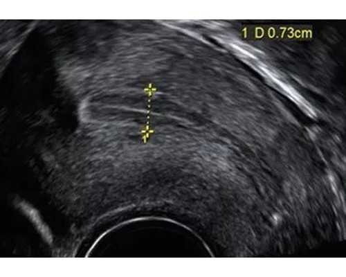 香港验血测胎儿性别抽哪里的血_香港验血查询报告真假_查性别真的准确吗!