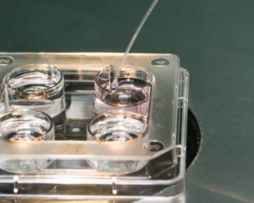 香港验血7周女宝8周男宝_香港验血会不会是骗局根本没验_胎儿鉴定详细流程是