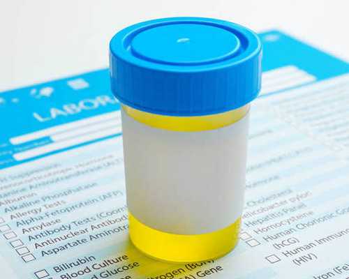 香港验血需要几周条件,高龄做泰国试管前期做好哪些准备?