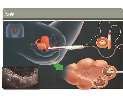 香港化验所有限公司可以邮寄验血吗,女性子宫肌瘤赴美做试管婴儿，可以直接