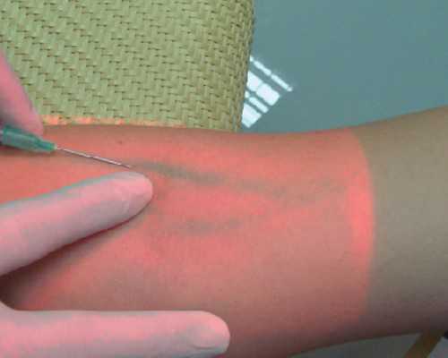 香港7周验血是男孩会生女孩吗,基础体温监测：备孕必不可少！既能指导怀孕，