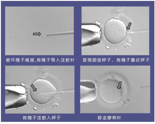 古玩收藏类单机游戏_艺术关税降至3％影响甚微 天价作品无奈搁境外