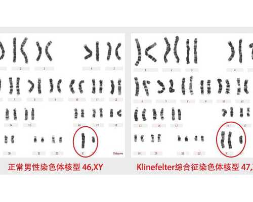 香港验血b超周数大_香港戴学良验血结果_怎么预约去香港验血