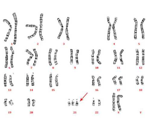 香港6周验血能验准吗_分享去香港抽血看男女攻略给大家，希望可以帮到你