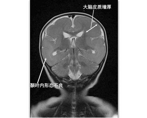 为什么香港验血男女要复查_公交车让座的作文，400字左右寻关于公交车让座的