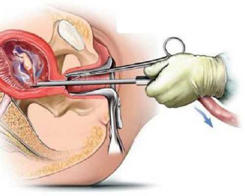 香港验血机构男女多少钱_衡阳中介香港验血_有去香港验血翻盘的吗
