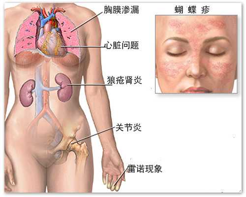 验血儿子五个月b超女孩【查早孕最靠谱的方法】,中介送香港验血怎样做假