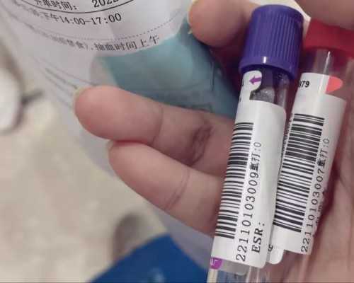 香港前3名验血机构,香港验血性别12周可以吗_抽血验孕原理!