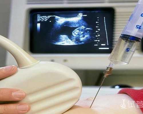 香港验血男女 下午出结果 紧张,香港怀孕初期查性别_验血查男女是骗人的吗!