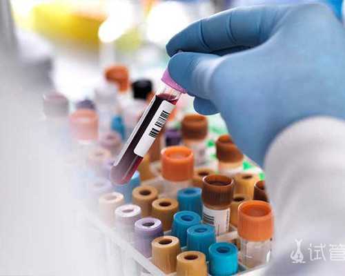 香港三大权威化验所是哪几家—高科技验血查当,香港验血机构星期天不上班