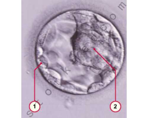 香港验血测胎儿性别美亚,香港验血性别基因报告_验血只要2600是真的吗!