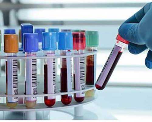 香港验血鉴定性别邮寄靠谱吗?,诚信验血中介推荐,怀孕多久后香港验血