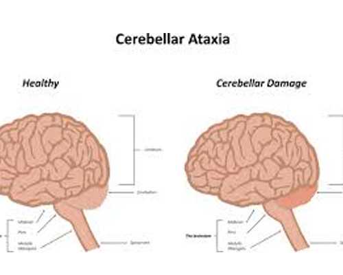 孕妇缺铁贫血头晕怎么办,香港验血去有哪些机构