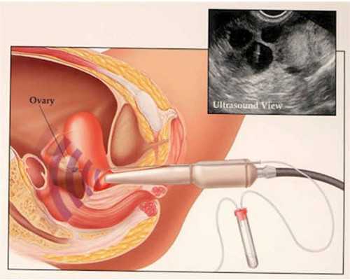 都市古玩大师,香煎鸡脯肉的做法