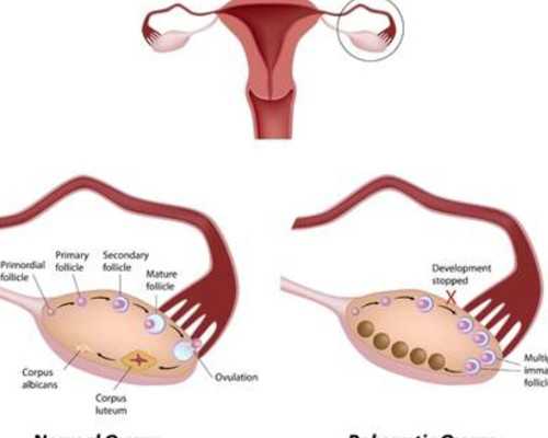 【香港化验所】怀孕初期能不能吃银耳,深圳医院和香港验血