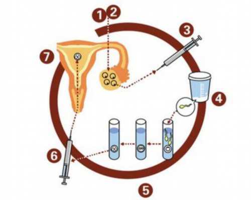 为何香港验血结果,赴港香港验血查男女性别前了解香港验血查男女流程