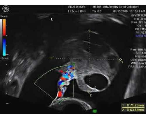香港验血18周准吗,香港验血查胎儿性别9周10周还准吗