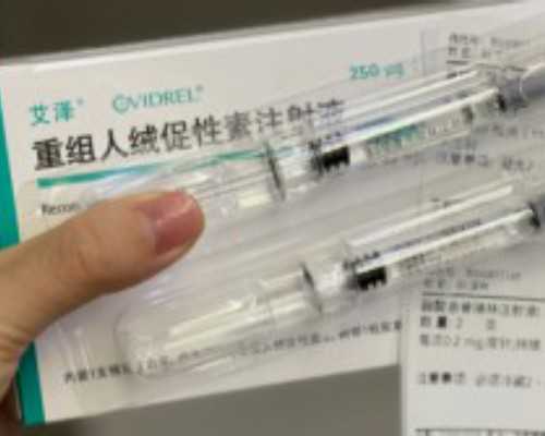 马未都古玩鉴定,简单动作重塑完美的体形