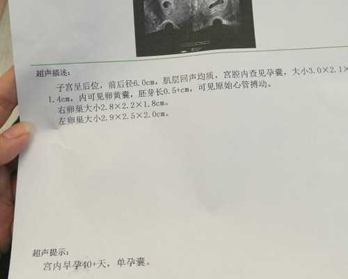 古玩铜钱鉴定及价格,盘点六大健康生活减肥窍门