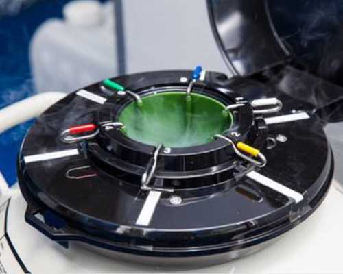 我想学古玩鉴定去哪里学,刚怀孕孕酮低正常吗