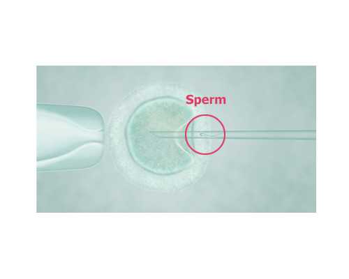 香港卓信验血查胎儿性别准吗,关于香港检测男女性别的最佳时期你真的知道吗