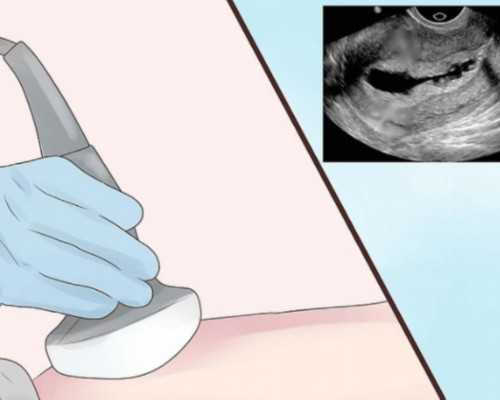 孕妇什么时候可以吃海参,怀孕11周香港验血