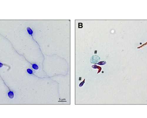 香港验血为什么要满7周,婚前检查包含血型配对吗